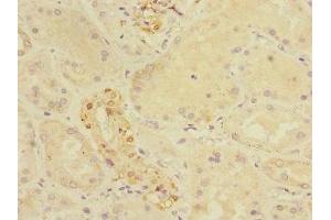 Immunohistochemistry of paraffin-embedded human kidney tissue using ABIN7149052 at dilution of 1:100 (CRIP1 antibody  (AA 1-77))
