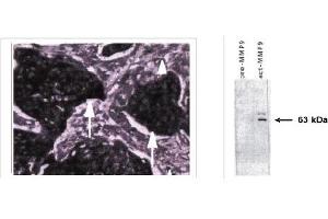 Immunohistochemistry (IHC) image for anti-Matrix Metallopeptidase 9 (Gelatinase B, 92kDa Gelatinase, 92kDa Type IV Collagenase) (MMP9) (active), (N-Term) antibody (ABIN264508)