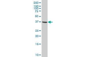 PPP2R4 polyclonal antibody (A01), Lot # 051212JC01 Western Blot analysis of PPP2R4 expression in HL-60 . (PPP2R4 antibody  (AA 21-120))