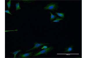 Immunofluorescence of monoclonal antibody to TLN1 on HeLa cell. (TLN1 antibody  (AA 1324-1424))