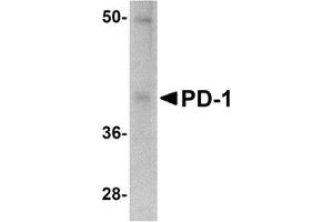 Western Blotting (WB) image for anti-Programmed Cell Death 1 (PDCD1) antibody (ABIN1031790) (PD-1 antibody)