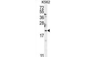 Western Blotting (WB) image for anti-BTG Family, Member 2 (BTG2) antibody (ABIN2995530) (BTG2 antibody)