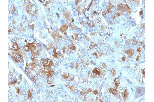 Formalin-fixed, paraffin-embedded human Adrenal Gland stained with Chromogranin A Mouse Monoclonal Antibody (CHGA/777)