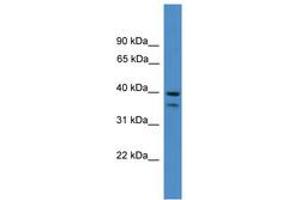 Image no. 1 for anti-serpin Peptidase Inhibitor, Clade B (Ovalbumin), Member 6 (SERPINB6) (AA 161-210) antibody (ABIN6745378)