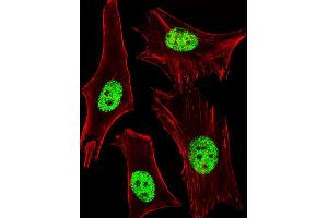 Fluorescent image of Hela cells stained with ARA Antibody (ABIN1944858 and ABIN2838532). (PPARA antibody  (AA 1-468))