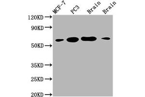 Recombinant LOXL2 antibody