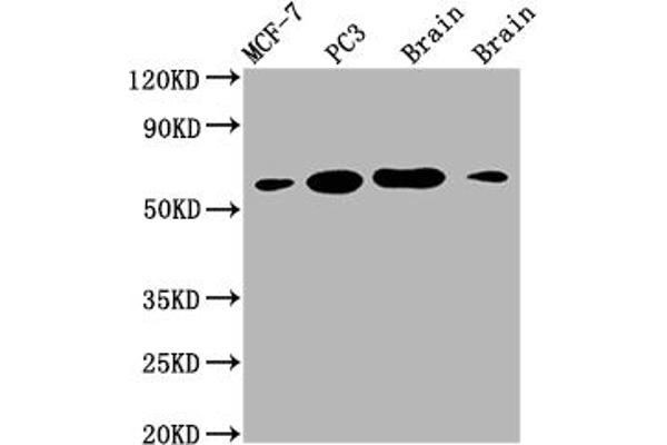 Recombinant LOXL2 antibody