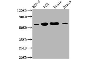 Western Blot Positive WB detected in: MCF-7 whole cell lysate, PC3 whole cell lysate, Mouse brain tissue, Rat brain tissue All lanes: LOXL2 antibody at 1:2000 Secondary Goat polyclonal to rabbit IgG at 1/50000 dilution Predicted band size: 87 kDa Observed band size: 53 kDa (Recombinant LOXL2 antibody)