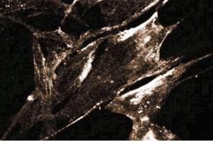 Immunoflurorescence staining of FHs cells (Normal human fetal lung fibroblasts, ATCC HTB-157). (Caveolin 2 antibody  (AA 42-162))