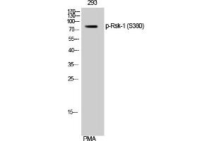 Western Blotting (WB) image for anti-Ribosomal Protein S6 Kinase, 90kDa, Polypeptide 1 (RPS6KA1) (pSer380) antibody (ABIN5957341) (RPS6KA1 antibody  (pSer380))