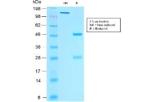 SDS-PAGE Analysis of Purified Estrogen Receptor, alpha Mouse Monoclonal Antibody (rESR1/1935). (Recombinant Estrogen Receptor alpha antibody)