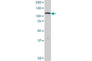 ADAMTS17 monoclonal antibody (M01), clone 3B7 Western Blot analysis of ADAMTS17 expression in A-431 . (ADAMTS17 antibody  (AA 543-650))