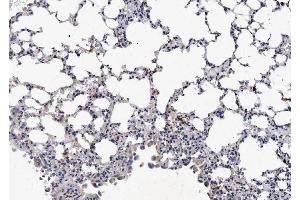 IHC analysis of NCR1 using anti-NCR1 antibody (ABIN5693031). (NCR1 antibody  (AA 22-258))