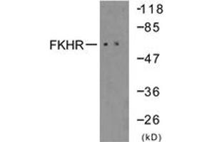 Western blot analysis of extracts from 293 cells, treated with serum 10% 15', using FKHR (Ab-319) Antibody. (FOXO1 antibody  (AA 286-335))