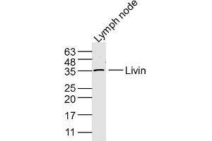 Mouse Lymph node lysates probed with Livin Polyclonal Antibody, Unconjugated  at 1:300 dilution and 4˚C overnight incubation. (BIRC7 antibody  (AA 101-200))