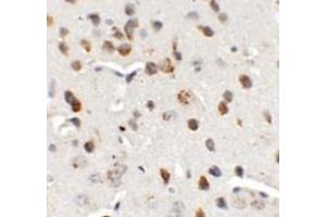 Immunohistochemistry of CHD7 in mouse brain tissue with CHD7 antibody at 5 ug/mL. (CHD7 antibody  (N-Term))