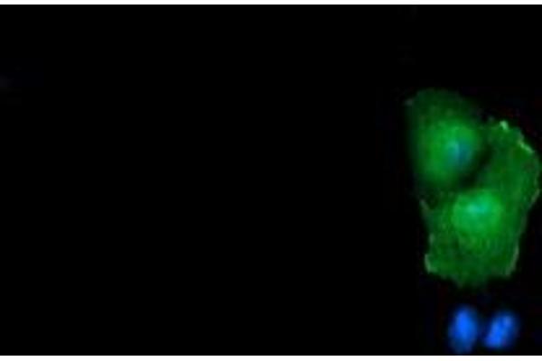RHOJ antibody