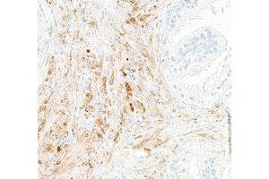 Immunohistochemistry (IHC) image for anti-Ubiquitin Carboxyl-terminal Esterase L1 (Ubiquitin Thiolesterase) (UCHL1) (AA 50-100) antibody (ABIN7449527) (Recombinant UCHL1 antibody  (AA 50-100))