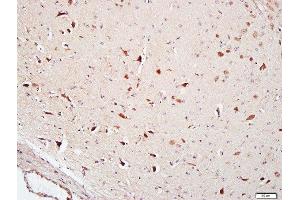 Paraformaldehyde-fixed, paraffin embedded Mouse Brain tissue, Antigen retrieval by boiling in sodium citrate buffer(pH6) for 15min, Block endogenous peroxidase by 3% hydrogen peroxide for 20 minutes, Blocking buffer (normal goat serum) at 37°C for 30min, Antibody incubation with FAM134B Polyclonal Antibody, Unconjugated  at 1:400 overnight at 4°C, followed by a conjugated secondary and DAB staining (FAM134B antibody  (AA 210-310))