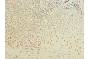 Immunohistochemistry of paraffin-embedded human tonsil tissue using ABIN7175990 at dilution of 1:100 (ZBTB6 antibody  (AA 115-424))