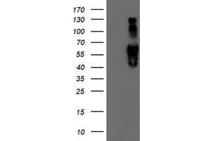 HEK293T cells were transfected with the pCMV6-ENTRY control (Left lane) or pCMV6-ENTRY IDS (Right lane) cDNA for 48 hrs and lysed. (IDS antibody)
