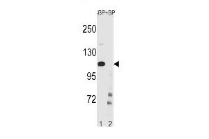 IKKB Antibody (Center ) (ABIN1881454 and ABIN2843238) western blot analysis in CEM cell line lysates (35 μg/lane).