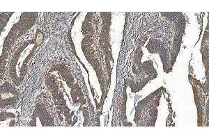 IHC analysis of YTHDF2 using anti-YTHDF2 antibody (ABIN7603191). (YTHDF2 antibody  (N-Term))