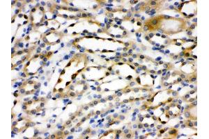Immunohistochemistry (IHC) image for anti-Actinin, alpha 4 (ACTN4) (AA 561-661) antibody (ABIN4886421)
