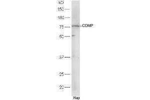 Raji cell lysates probed with Rabbit Anti-COMP Polyclonal Antibody, Unconjugated (ABIN2559644) at 1:300 in 4˚C. (COMP antibody  (AA 221-320))