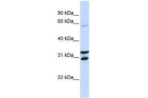 FBXO24 antibody used at 1 ug/ml to detect target protein. (FBXO24 antibody  (N-Term))