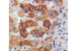 #VALUE! (Apolipoprotein M antibody  (AA 20-190))