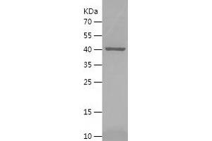 Western Blotting (WB) image for serpin Peptidase Inhibitor, Clade B (Ovalbumin), Member 8 (SERPINB8) (AA 1-374) protein (His tag) (ABIN7125053) (SERPINB8 Protein (AA 1-374) (His tag))