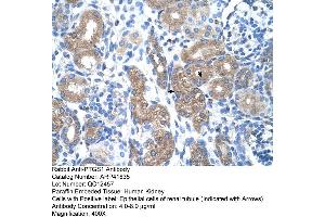 Rabbit Anti-PTGS1 Antibody  Paraffin Embedded Tissue: Human Kidney Cellular Data: Epithelial cells of renal tubule Antibody Concentration: 4. (PTGS1 antibody  (N-Term))