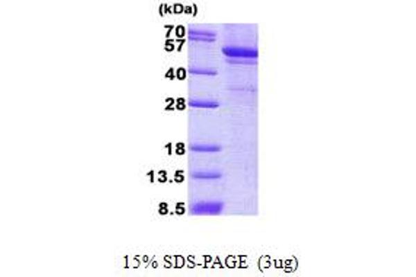 LPCAT1 Protein (His tag)