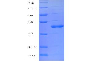 TMEM66 Protein (AA 195-339) (His-SUMO Tag)