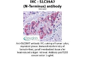 Image no. 2 for anti-Solute Carrier Family 39 (Zinc Transporter), Member 7 (SLC39A7) (N-Term) antibody (ABIN1739379) (SLC39A7 antibody  (N-Term))