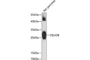 Western blot analysis of extracts of rat pancreas, using CELB antibody (ABIN6133505, ABIN6138397, ABIN6138398 and ABIN6217810) at 1:3000 dilution. (Elastase 3B antibody  (AA 80-190))