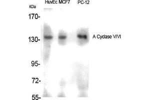 Western Blot (WB) analysis of specific cells using A Cyclase V/VI Polyclonal Antibody. (ADCY5/6 antibody  (C-Term))