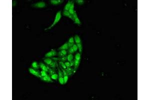 Immunofluorescent analysis of Hela cells using ABIN7158704 at dilution of 1:100 and Alexa Fluor 488-congugated AffiniPure Goat Anti-Rabbit IgG(H+L) (JMJD2D antibody  (AA 337-499))