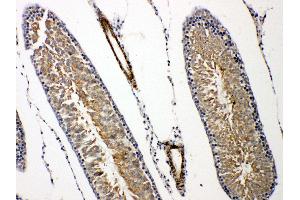 Prolactin Receptor antibody  (C-Term)