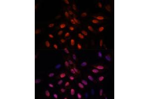 Immunofluorescence analysis of U-2 OS cells using TPI1 antibody (ABIN7270977) at dilution of 1:100. (TPI1 antibody  (AA 1-249))