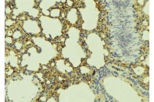 Immunohistochemistry (IHC) image for anti-Adenylate Cyclase Activating Polypeptide 1 (Pituitary) Receptor Type I (ADCYAP1R1) (C-Term) antibody (ABIN6266185)