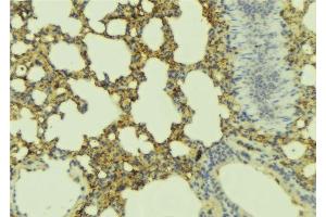 ABIN6277452 at 1/100 staining Mouse lung tissue by IHC-P.