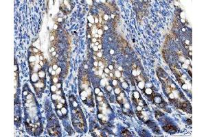 IHC analysis of TRK fused gene/TFG using anti-TRK fused gene/TFG antibody (ABIN7599839). (TFG antibody  (AA 121-400))