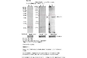 Sample Type: 1. (RAB1B antibody  (C-Term))