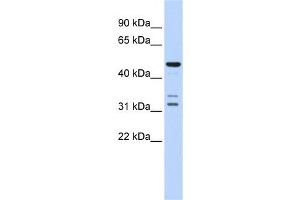 Western Blotting (WB) image for anti-HtrA Serine Peptidase 4 (HTRA4) antibody (ABIN2459938) (HTRA4 antibody)