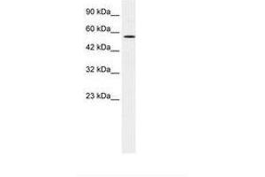 Image no. 2 for anti-Meis Homeobox 2 (MEIS2) (AA 50-99) antibody (ABIN202623) (MEIS2 antibody  (AA 50-99))