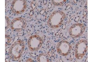 Detection of NES in Human Kidney Tissue using Monoclonal Antibody to Nestin (NES) (Nestin antibody  (AA 178-399))