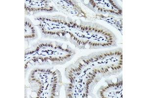 Immunohistochemistry of paraffin-embedded mouse stomach using FOSB Rabbit pAb (ABIN7267159) at dilution of 1:150 (40x lens). (FOSB antibody  (AA 1-100))