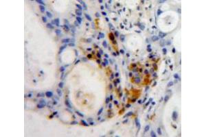 Used in DAB staining on fromalin fixed paraffin-embedded Pancreas tissue (MNDA antibody  (AA 189-405))